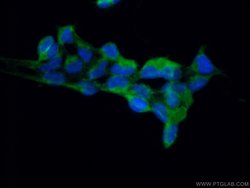 RPAP2 Rabbit anti-Human, Mouse, Polyclonal, Proteintech:Antibodies:Primary