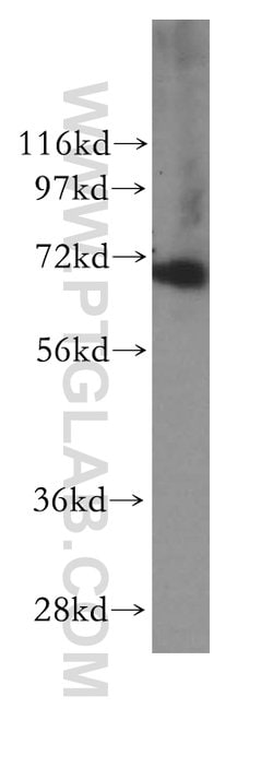 RPAP2 Rabbit anti-Human, Mouse, Polyclonal, Proteintech:Antibodies:Primary