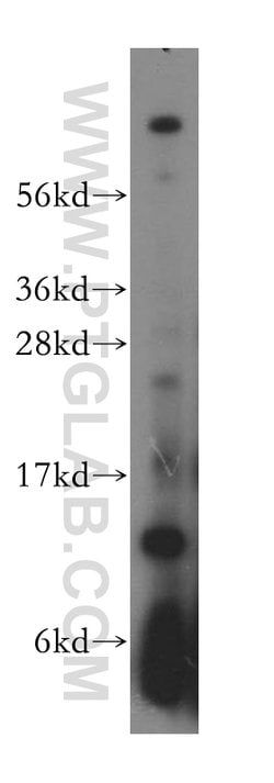 RPL30 Rabbit anti-Human, Mouse, Rat, Polyclonal, Proteintech 150 &mu;L;