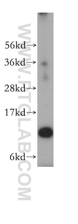 RPL30 Rabbit anti-Human, Mouse, Rat, Polyclonal, Proteintech 150 &mu;L;