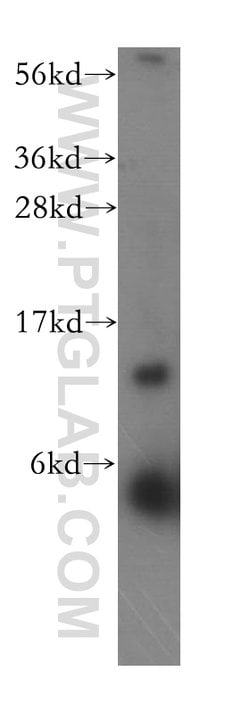 RPL30 Rabbit anti-Human, Mouse, Rat, Polyclonal, Proteintech 150 &mu;L;