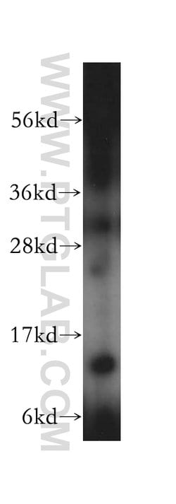 RPL30 Rabbit anti-Human, Mouse, Rat, Polyclonal, Proteintech 150 &mu;L;