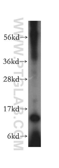 RPL30 Rabbit anti-Human, Mouse, Rat, Polyclonal, Proteintech 150 &mu;L;