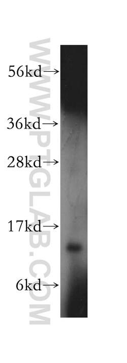 RPL30 Rabbit anti-Human, Mouse, Rat, Polyclonal, Proteintech 150 &mu;L;