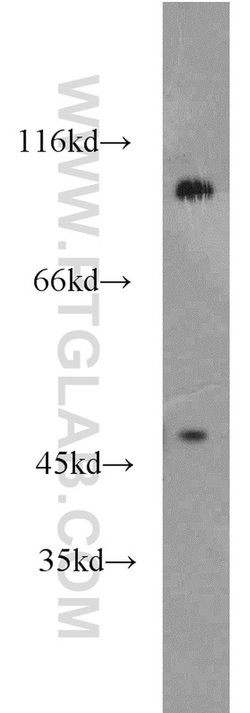 PSD2 Rabbit anti-Human, Mouse, Rat, Polyclonal, Proteintech 150 &mu;L;