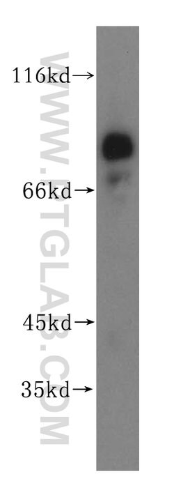 PSD2 Rabbit anti-Human, Mouse, Rat, Polyclonal, Proteintech 150 &mu;L;