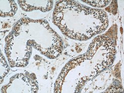 FJX1 Rabbit anti-Human, Mouse, Rat, Polyclonal, Proteintech 150 &mu;L;