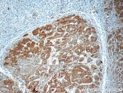 FJX1 Rabbit anti-Human, Mouse, Rat, Polyclonal, Proteintech 150 &mu;L;