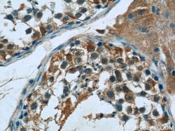 FJX1 Rabbit anti-Human, Mouse, Rat, Polyclonal, Proteintech 150 &mu;L;