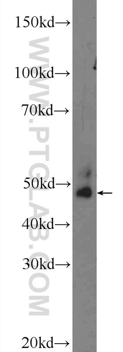 FJX1 Rabbit anti-Human, Mouse, Rat, Polyclonal, Proteintech 150 &mu;L;