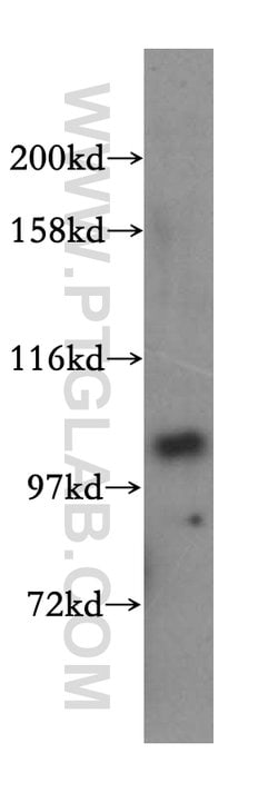 NARG1L Rabbit anti-Human, Mouse, Rat, Polyclonal, Proteintech 20 &mu;L;