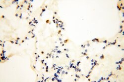 COQ5 Rabbit anti-Human, Mouse, Polyclonal, Proteintech 150 &mu;L; Unconjugated:Antibodies,