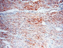 COQ5 Rabbit anti-Human, Mouse, Polyclonal, Proteintech 150 &mu;L; Unconjugated:Antibodies,