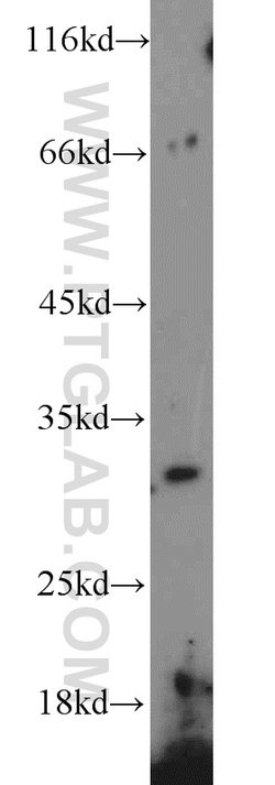 COQ5 Rabbit anti-Human, Mouse, Polyclonal, Proteintech 150 &mu;L; Unconjugated:Antibodies,