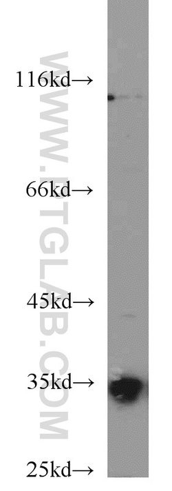 COQ5 Rabbit anti-Human, Mouse, Polyclonal, Proteintech 150 &mu;L; Unconjugated:Antibodies,