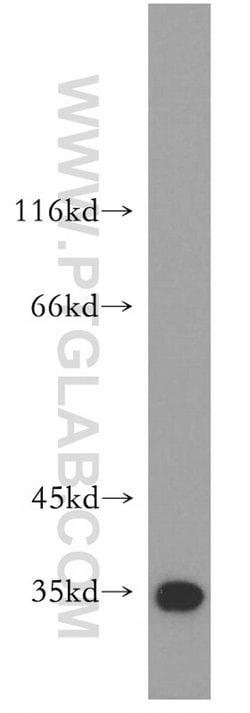 COQ5 Rabbit anti-Human, Mouse, Polyclonal, Proteintech 150 &mu;L; Unconjugated:Antibodies,