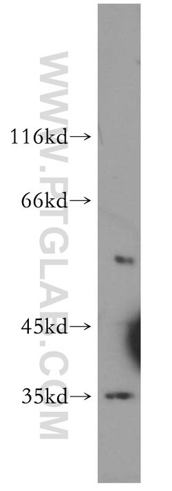 COQ5 Rabbit anti-Human, Mouse, Polyclonal, Proteintech 150 &mu;L; Unconjugated:Antibodies,