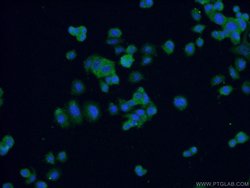 FABP7 Rabbit anti-Human, Mouse, Rat, Polyclonal, Proteintech:Antibodies:Primary