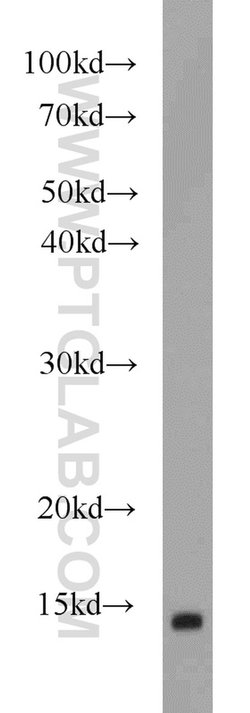 FABP7 Rabbit anti-Human, Mouse, Rat, Polyclonal, Proteintech:Antibodies:Primary
