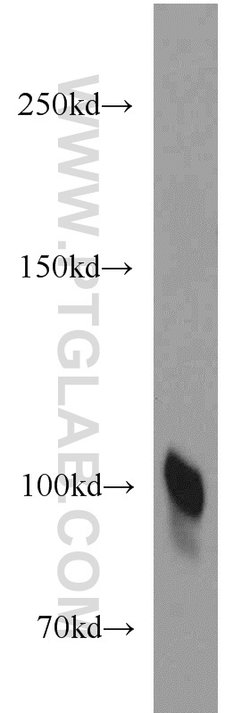 Plasminogen Rabbit anti-Human, Polyclonal, Proteintech 150 &mu;L; Unconjugated:Antibodies,