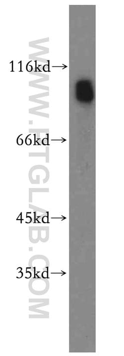 Plasminogen Rabbit anti-Human, Polyclonal, Proteintech 150 &mu;L; Unconjugated:Antibodies,