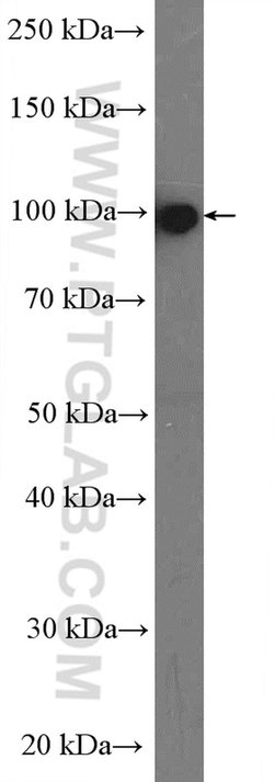 Plasminogen Rabbit anti-Human, Polyclonal, Proteintech 150 &mu;L; Unconjugated:Antibodies,