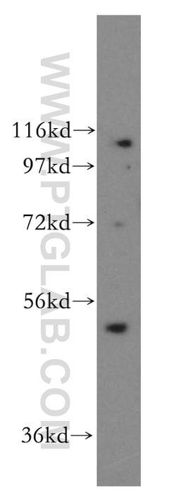 CLUAP1 Rabbit anti-Canine, Human, Mouse, Rat, Polyclonal, Proteintech:Antibodies:Primary