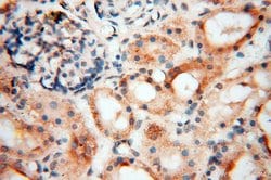 USP20 Rabbit anti-Human, Mouse, Rat, Polyclonal, Proteintech 150 &mu;L;