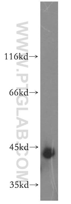 SPAG4L Rabbit anti-Human, Mouse, Polyclonal, Proteintech 150 &mu;L; Unconjugated:Antibodies,