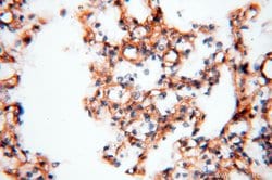 MYO1A Rabbit anti-Human, Mouse, Rat, Polyclonal, Proteintech 20 &mu;L | Buy Online | Proteintech | Fisher Scientific