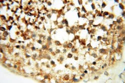 MYO1A Rabbit anti-Human, Mouse, Rat, Polyclonal, Proteintech 20 &mu;L | Buy Online | Proteintech | Fisher Scientific