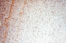 MYO1A Rabbit anti-Human, Mouse, Rat, Polyclonal, Proteintech 20 &mu;L | Buy Online | Proteintech | Fisher Scientific