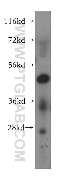 MAK16 Rabbit anti-Human, Mouse, Rat, Polyclonal, Proteintech 150 &mu;L;