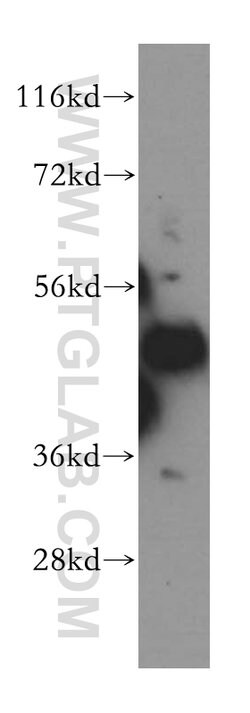 MAK16 Rabbit anti-Human, Mouse, Rat, Polyclonal, Proteintech 150 &mu;L;