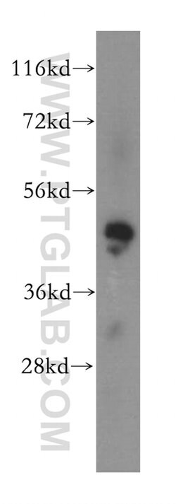 MAK16 Rabbit anti-Human, Mouse, Rat, Polyclonal, Proteintech 150 &mu;L;
