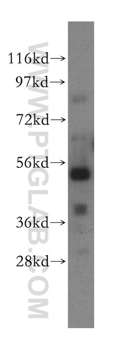 TOM1 Rabbit anti-Human, Mouse, Rat, Polyclonal, Proteintech 150 &mu;L;