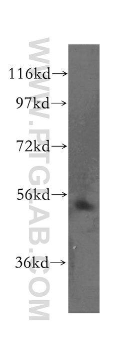 TOM1 Rabbit anti-Human, Mouse, Rat, Polyclonal, Proteintech 150 &mu;L;
