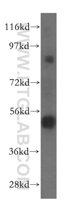 TOM1 Rabbit anti-Human, Mouse, Rat, Polyclonal, Proteintech 150 &mu;L;