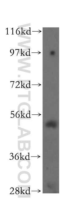 TOM1 Rabbit anti-Human, Mouse, Rat, Polyclonal, Proteintech 150 &mu;L;