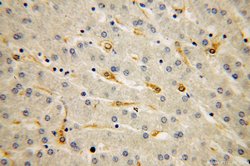 IRS1 Rabbit anti-Human, Polyclonal, Proteintech:Antibodies:Primary Antibodies