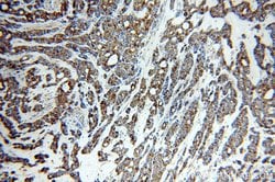 Cytokeratin 7 Rabbit anti-Human, Polyclonal, Proteintech 150 &mu;L; Unconjugated:Antibodies,