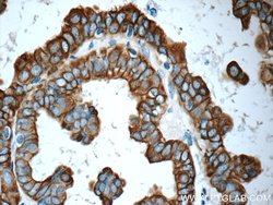 Cytokeratin 7 Rabbit anti-Human, Polyclonal, Proteintech 150 &mu;L; Unconjugated:Antibodies,
