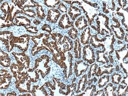 Cytokeratin 7 Rabbit anti-Human, Polyclonal, Proteintech 150 &mu;L; Unconjugated:Antibodies,