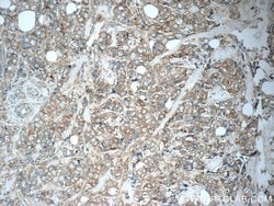 Cytokeratin 7 Rabbit anti-Human, Polyclonal, Proteintech 150 &mu;L; Unconjugated:Antibodies,