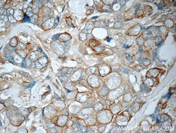 Cytokeratin 7 Rabbit anti-Human, Polyclonal, Proteintech 150 &mu;L; Unconjugated:Antibodies,