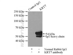 Cytokeratin 7 Rabbit anti-Human, Polyclonal, Proteintech 150 &mu;L; Unconjugated:Antibodies,