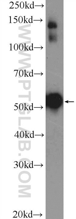Cytokeratin 7 Rabbit anti-Human, Polyclonal, Proteintech 150 &mu;L; Unconjugated:Antibodies,