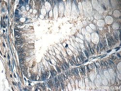 ACADL Rabbit anti-Human, Mouse, Rat, Polyclonal, Proteintech:Antibodies:Primary