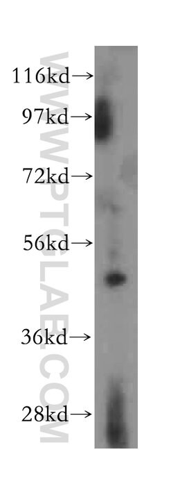ACADL Rabbit anti-Human, Mouse, Rat, Polyclonal, Proteintech:Antibodies:Primary