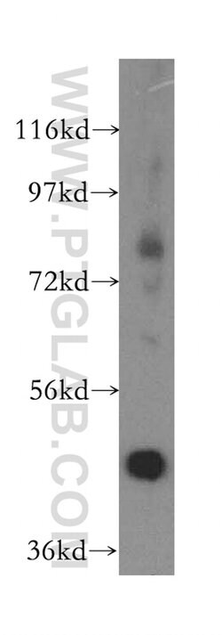 ACADL Rabbit anti-Human, Mouse, Rat, Polyclonal, Proteintech:Antibodies:Primary